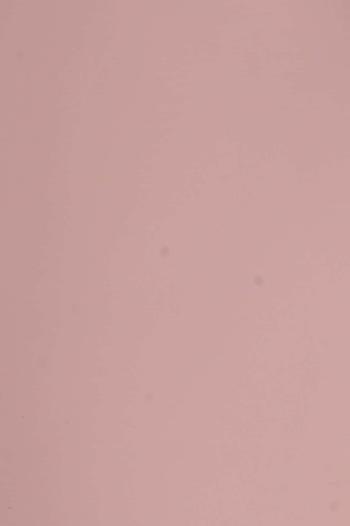 Dana Supozulato Pembe